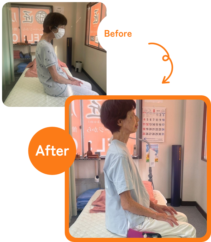 慢性的な肩こり Before→After